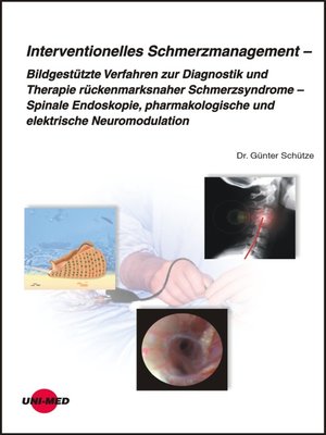 cover image of Interventionelles Schmerzmanagement